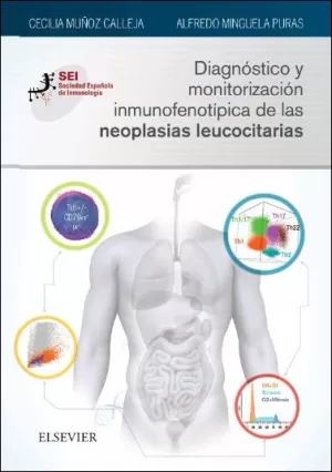 Diagnóstico y Monitorización Inmunofenotipica de las Neoplasias Leucocitarias